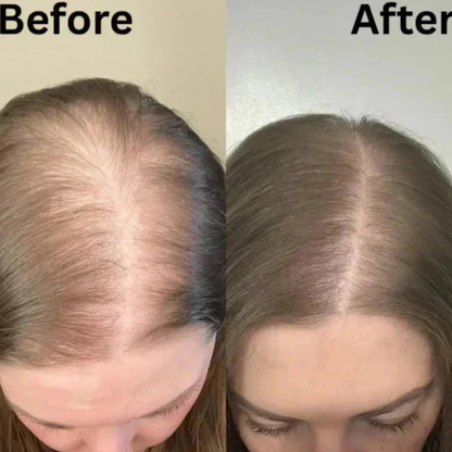 Misorra™ Rosemary Shampoo - 100ml