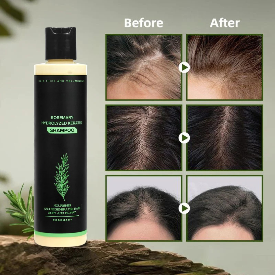 Misorra™ Rosemary Shampoo - 100ml