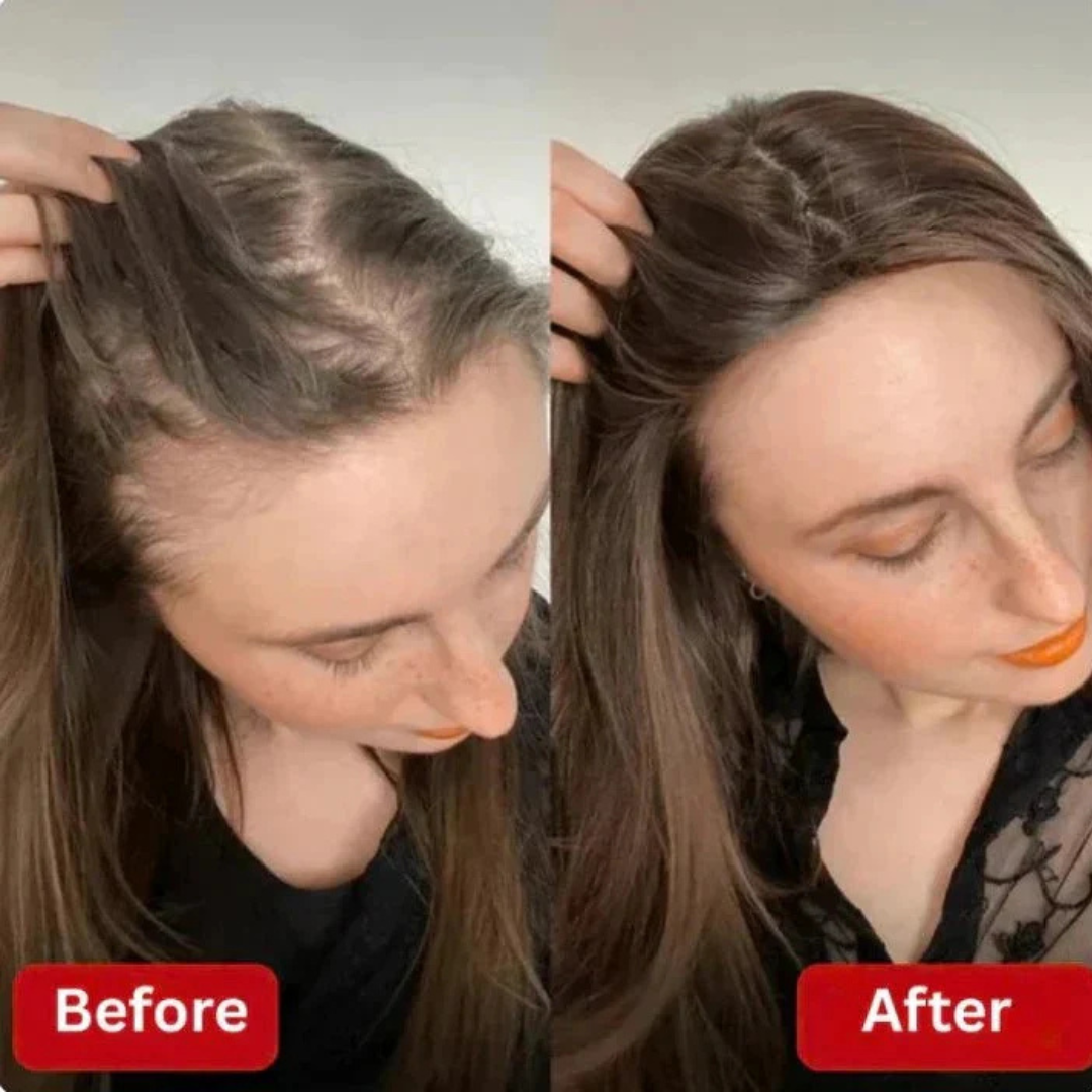 Misorra™ Rosemary Shampoo - 100ml